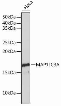 MAP1LC3A Rabbit monoclonal antibody