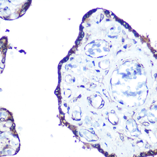 MAP1LC3A Rabbit monoclonal antibody