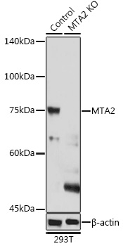 [KO Validated] MTA2 Rabbit polyclonal antibody