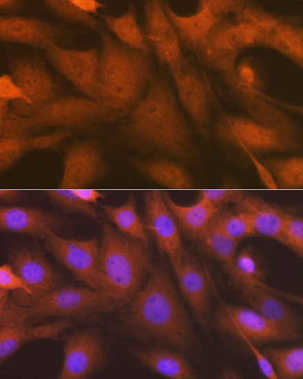 ALKBH1 Rabbit monoclonal antibody