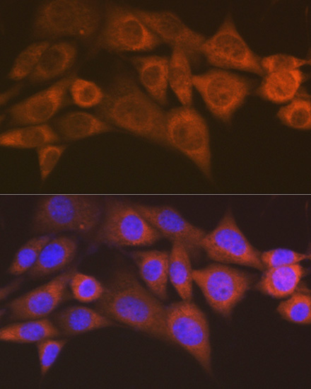 ALKBH1 Rabbit monoclonal antibody