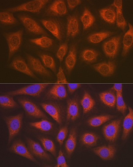 ALKBH1 Rabbit monoclonal antibody