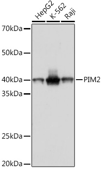 PIM2 Rabbit monoclonal antibody