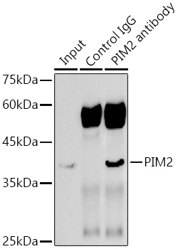 PIM2 Rabbit monoclonal antibody