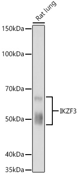 IKZF3 Rabbit monoclonal antibody