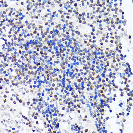 IKZF3 Rabbit monoclonal antibody