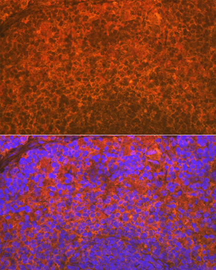 IKZF3 Rabbit monoclonal antibody