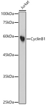 Cyclin B1 Rabbit monoclonal antibody