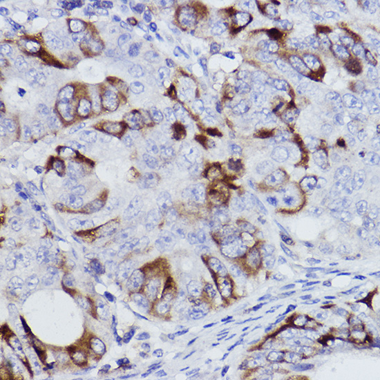 Cyclin B1 Rabbit monoclonal antibody