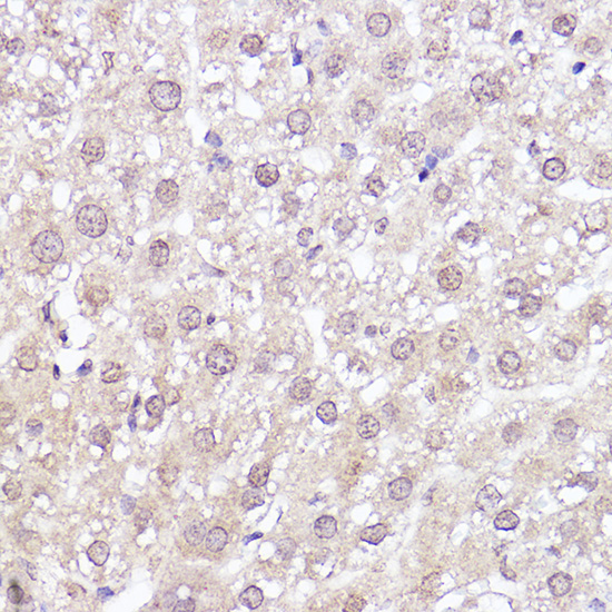MEK1 Rabbit monoclonal antibody