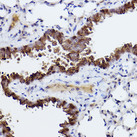 Caspase-6 Rabbit monoclonal antibody
