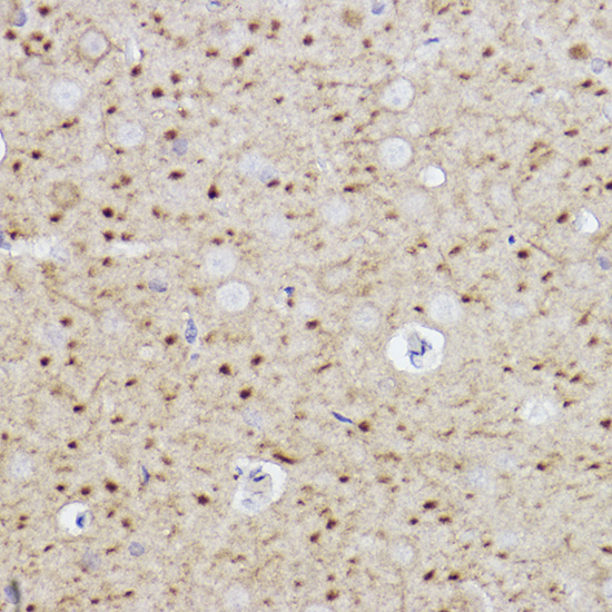 Caspase-6 Rabbit monoclonal antibody