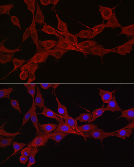 KRAS+HRAS+NRAS Rabbit monoclonal antibody
