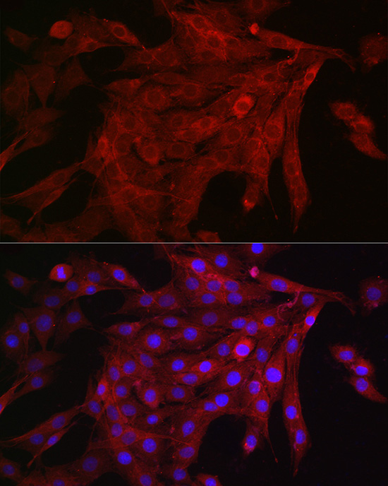 KRAS+HRAS+NRAS Rabbit monoclonal antibody