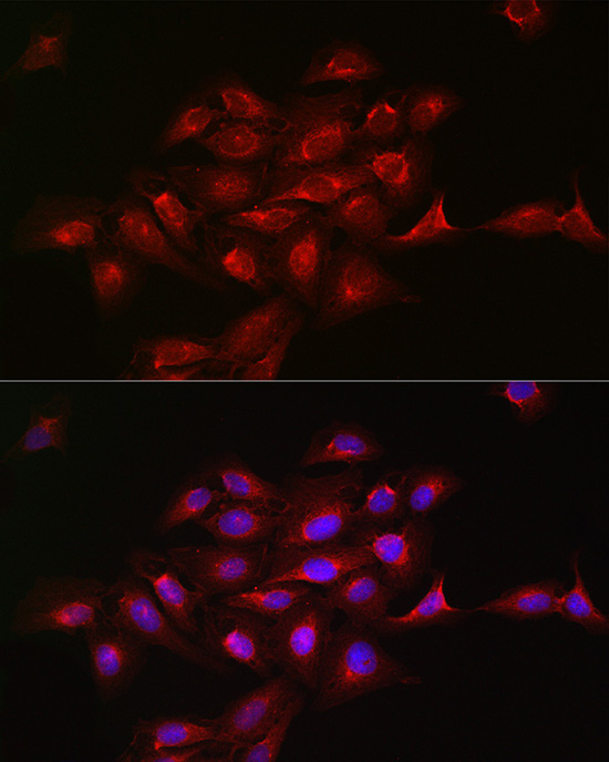 KRAS+HRAS+NRAS Rabbit monoclonal antibody