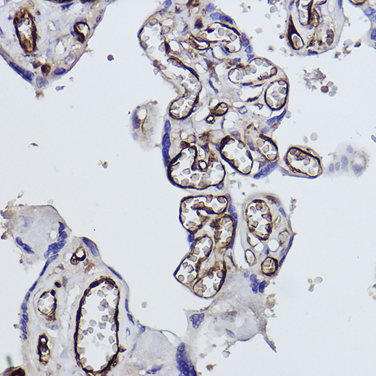 Tryptophanyl-tRNA synthetase 1 Rabbit monoclonal antibody