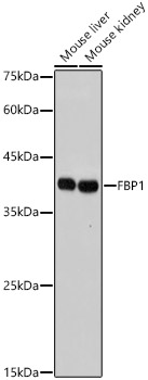 FBP1 Rabbit monoclonal antibody