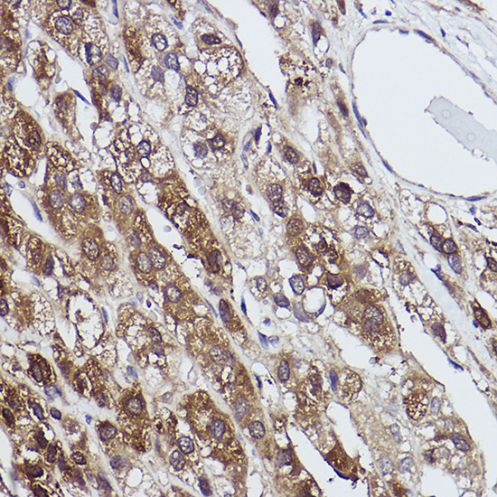 FBP1 Rabbit monoclonal antibody