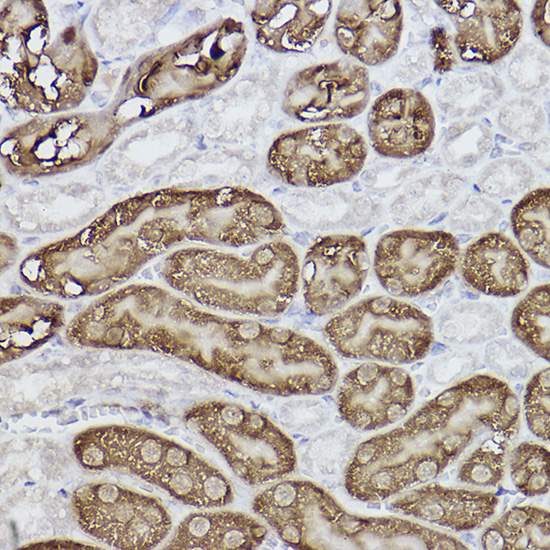 FBP1 Rabbit monoclonal antibody