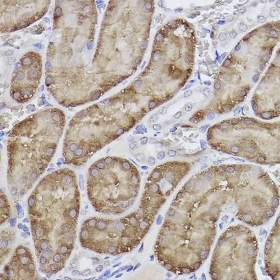 FBP1 Rabbit monoclonal antibody