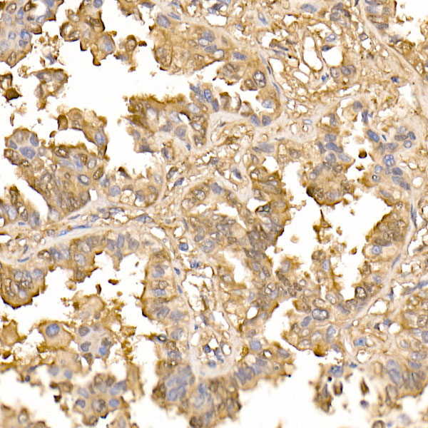 Galectin 3/LGALS3 Rabbit monoclonal antibody