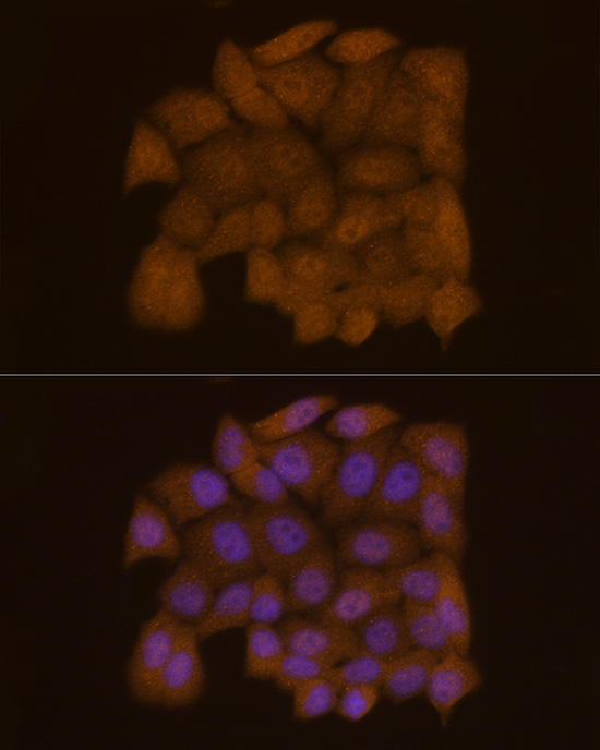 Galectin 3/LGALS3 Rabbit monoclonal antibody