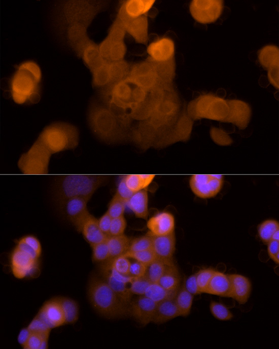 Galectin 3/LGALS3 Rabbit monoclonal antibody