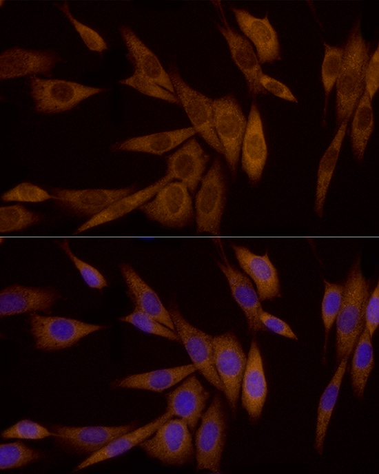 Galectin 3/LGALS3 Rabbit monoclonal antibody
