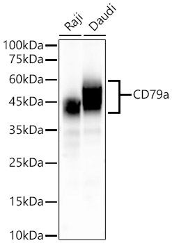 CD79a Rabbit monoclonal antibody