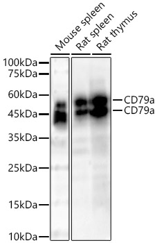 CD79a Rabbit monoclonal antibody
