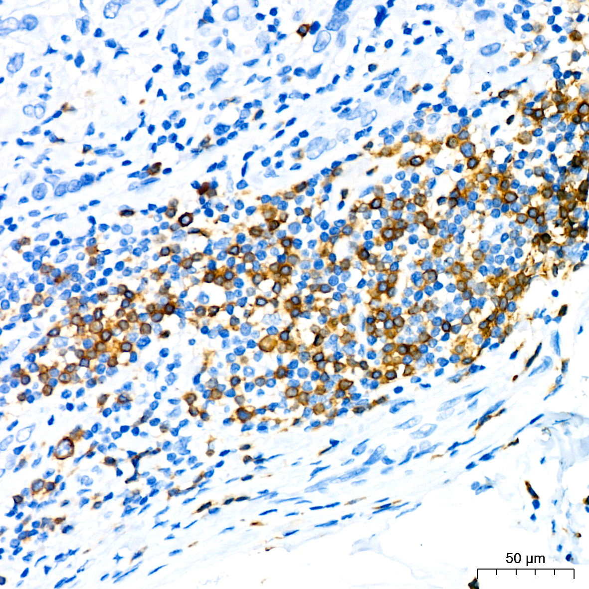 CD79a Rabbit monoclonal antibody