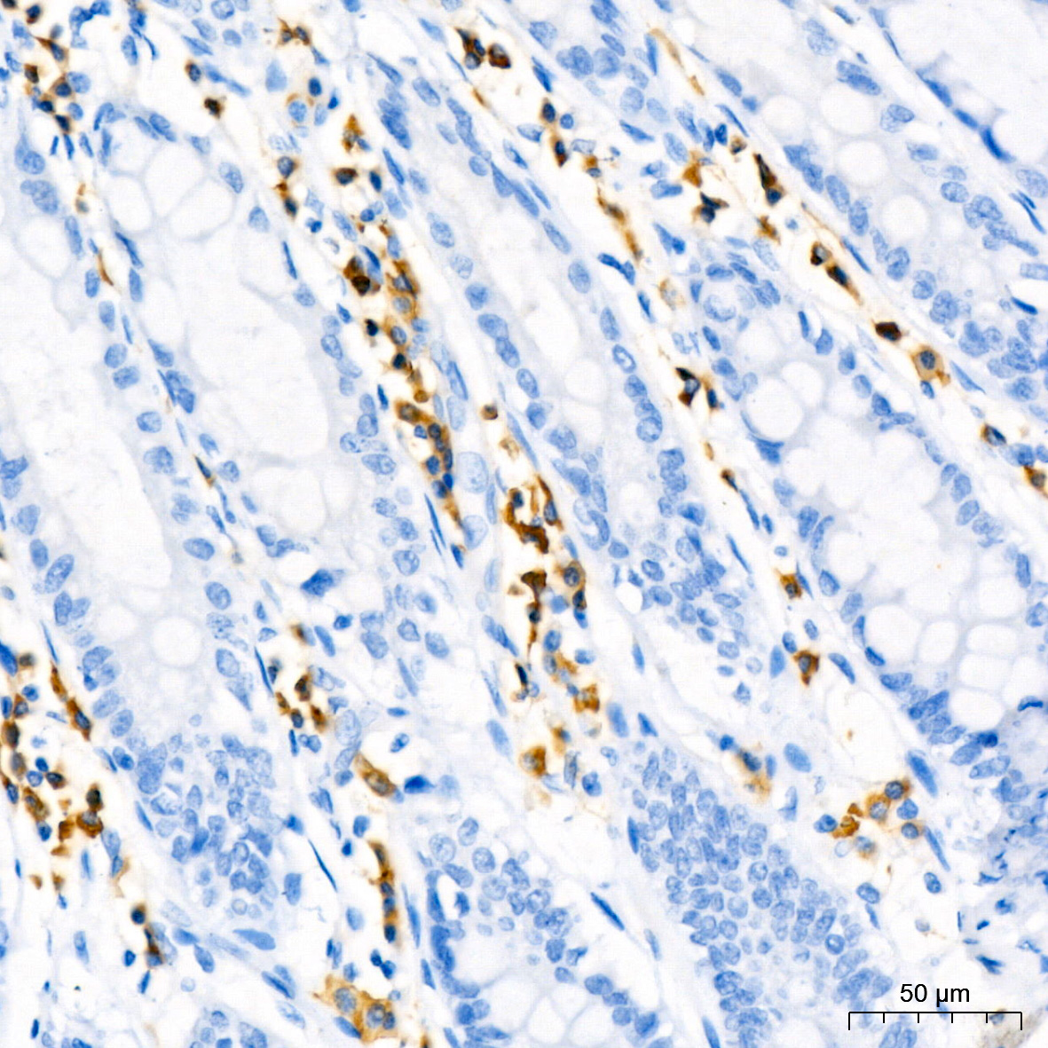 CD79a Rabbit monoclonal antibody