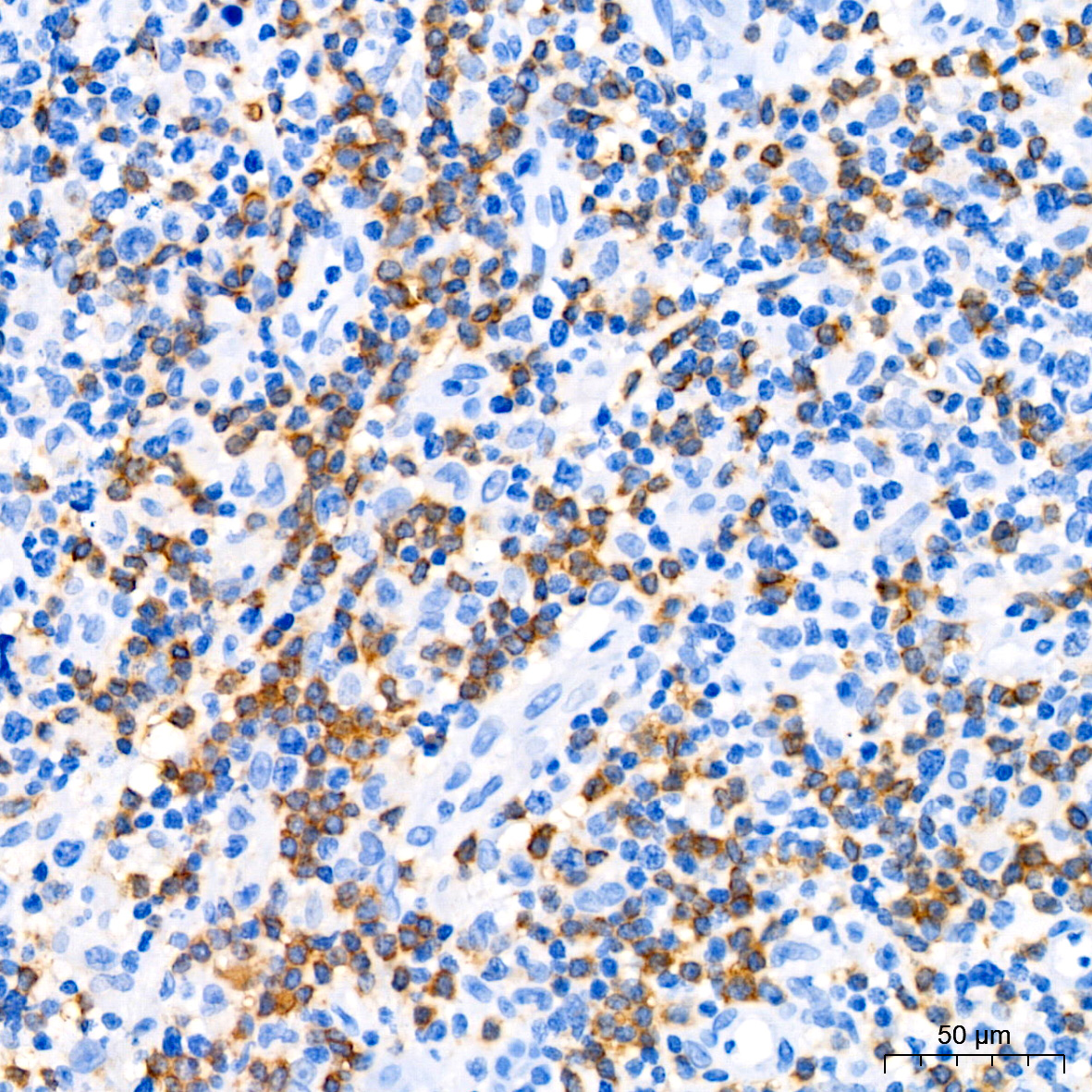 CD79a Rabbit monoclonal antibody