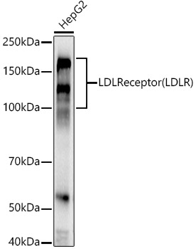 LDL Receptor (LDLR) Rabbit mAb