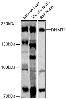DNMT1 Rabbit monoclonal antibody