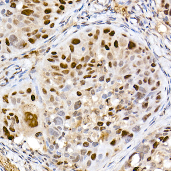 DNMT1 Rabbit monoclonal antibody