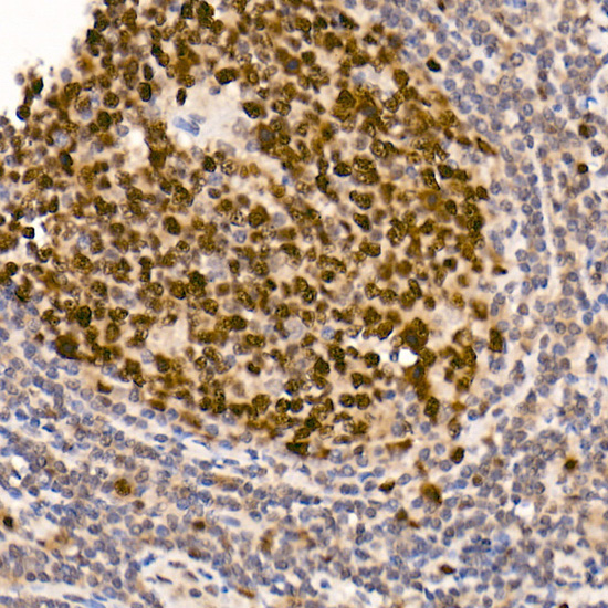 DNMT1 Rabbit monoclonal antibody