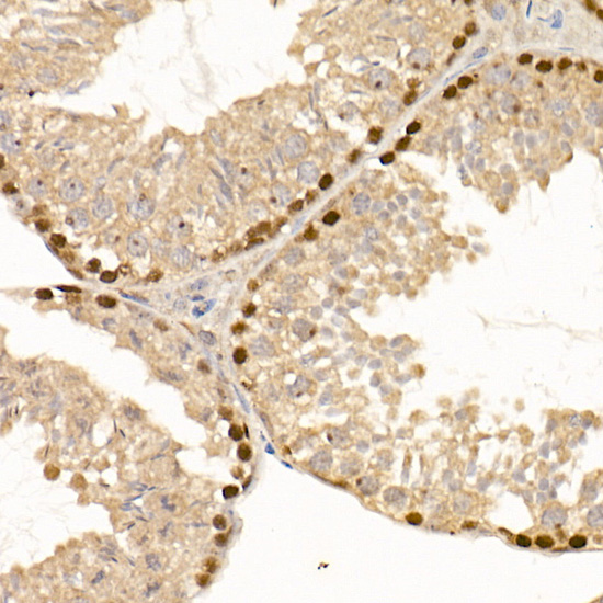 DNMT1 Rabbit monoclonal antibody