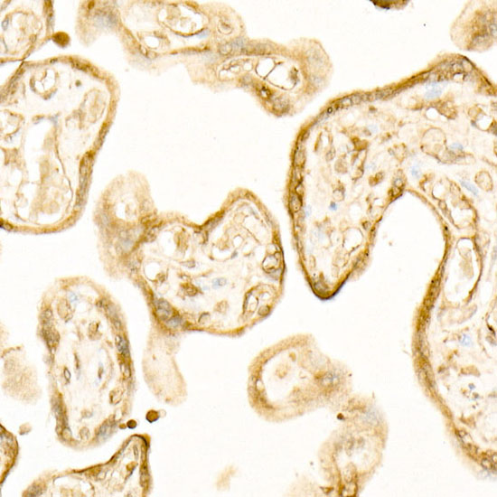 ATP6AP1 Rabbit monoclonal antibody
