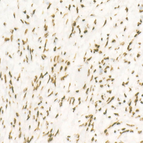 CDK12 Rabbit monoclonal antibody
