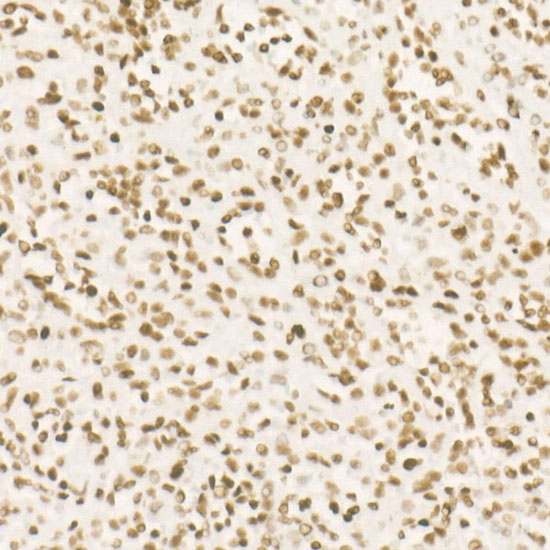 CDK12 Rabbit monoclonal antibody