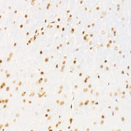 CDK12 Rabbit monoclonal antibody