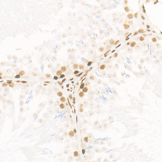 CDK12 Rabbit monoclonal antibody