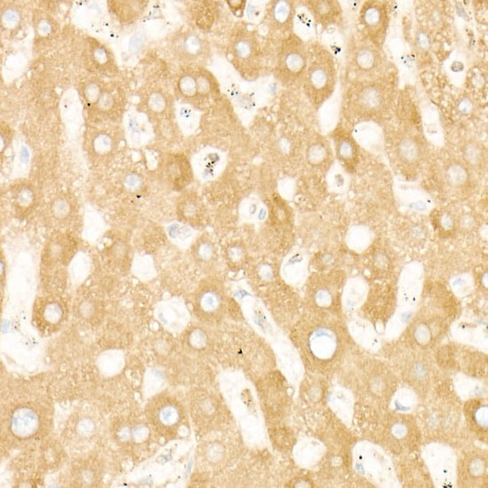 STIM1 Rabbit monoclonal antibody