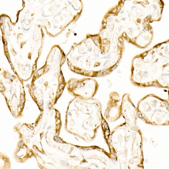 STIM1 Rabbit monoclonal antibody