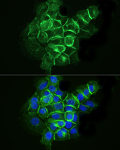 Immunofluorescence - ABflo® 488 Rabbit anti-Human CD142 mAb (A22492)