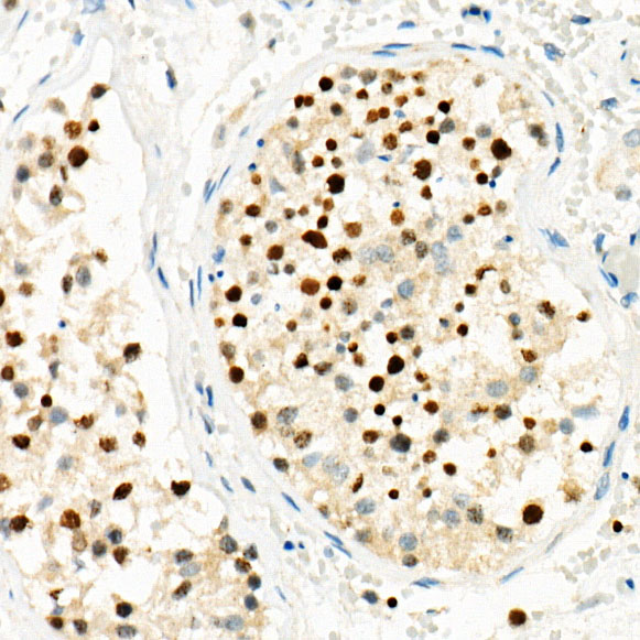 RNF8 Rabbit monoclonal antibody