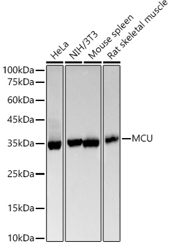 [KO Validated] MCU Rabbit monoclonal antibody