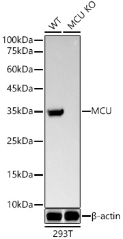 [KO Validated] MCU Rabbit monoclonal antibody