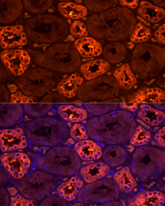 Tamm Horsfall Glycoprotein Rabbit polyclonal antibody